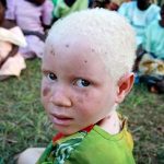 Племя негров-альбиносов нашли в Африке!