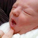 Зубастый новорожденный удивил акушеров